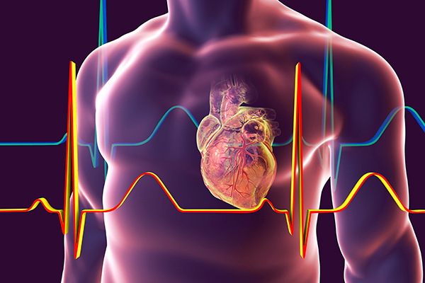 Como é tratada a cardiomiopatia dilatada?
