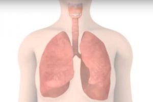 Conheça os sinais da infecção pulmonar