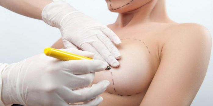 opções de pagamento para cirurgia de implante mamário